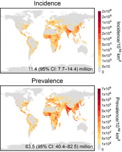 Global distribution of PM2.5-attributable burden of asthma in 2019